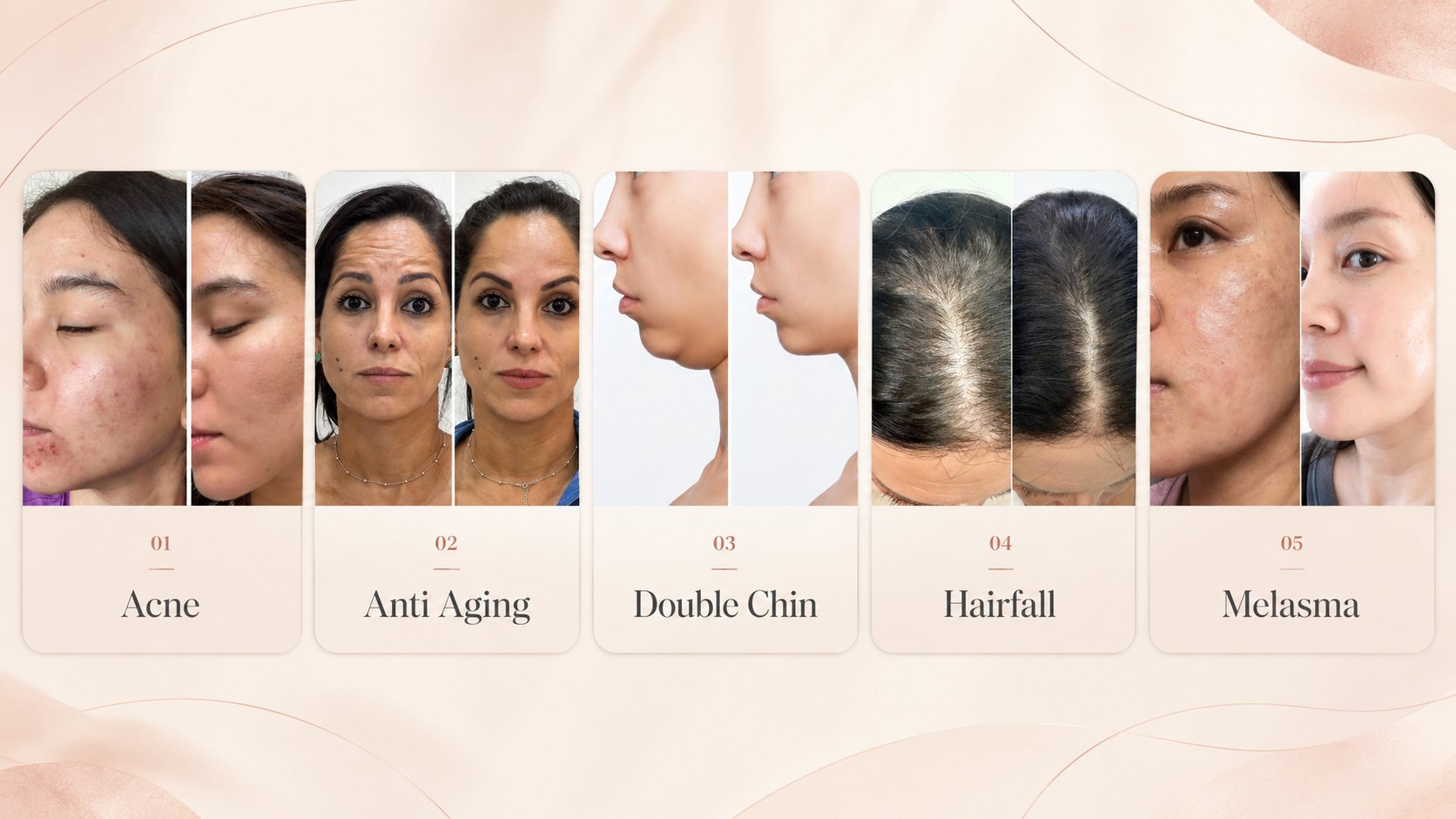 Five before-and-after photograph pairs, labelled acne, anti-ageing, double chin, hairfall and melasma.